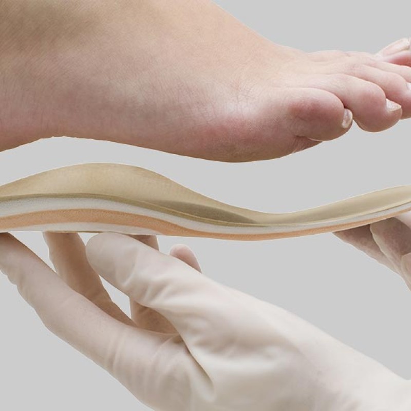 Συντηρητική Αποκατάσταση Βλαισότητας του Ποδιού με την Χρήση Ορθωτικών Πελμάτων