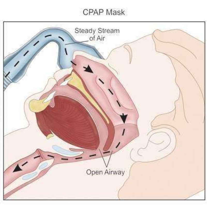 ΥΠΝΙΚΗ ΑΠΝΟΙΑ , ΥΠΕΥΘΥΝΗ ΚΑΙ ΓΙΑ ΤΡΟΧΑΙΑ ΑΤΥΧΗΜΑΤΑ