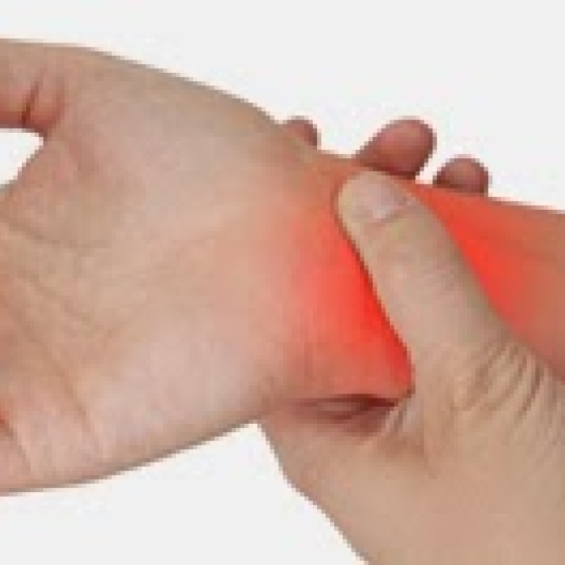 Τενοντίτιδα καρπού Τενοντίτιδα καρπού